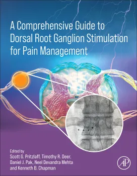 Cover of A Comprehensive Guide to Dorsal Root Ganglion Stimulation for Pain Management