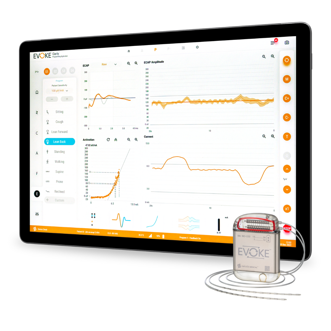 Evoke Therapy Group Shot Evoke SmartSCS implantable device with programming tablet displaying real-time spinal cord measurements